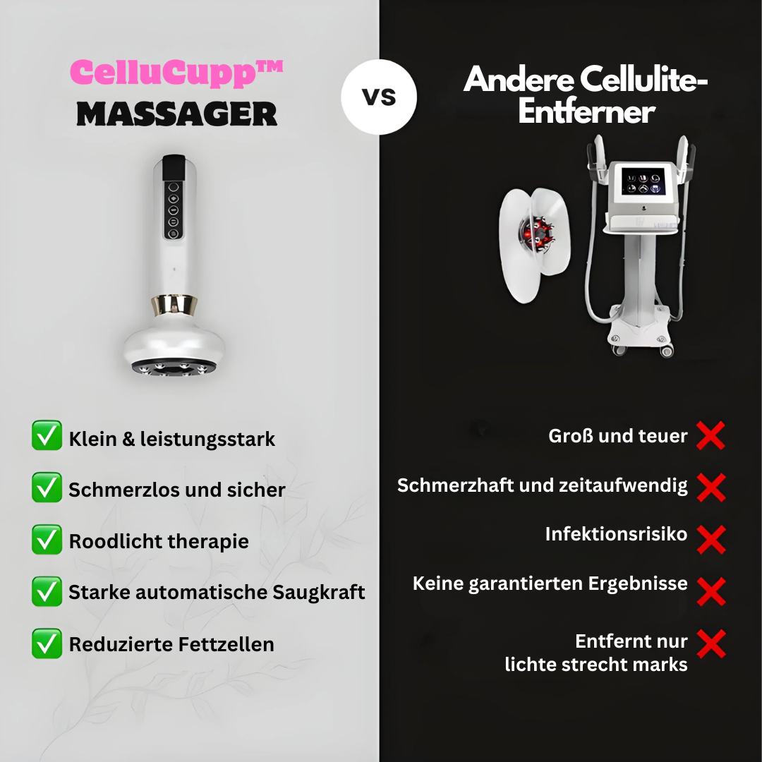 Cupping-apparaat voor Thuisgebruik 4