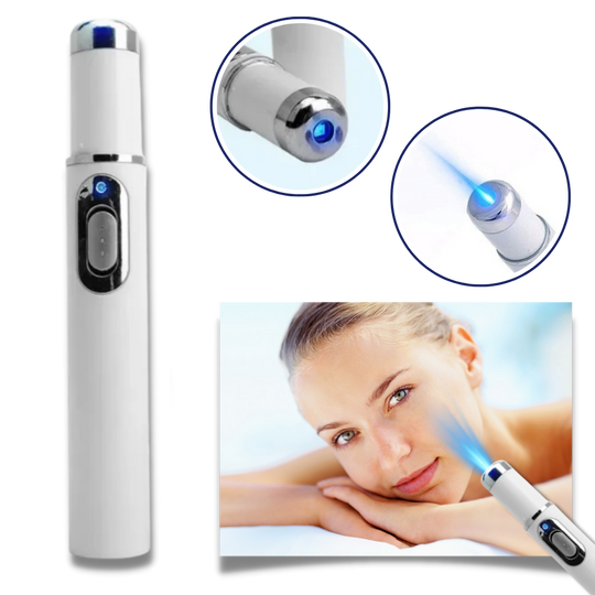 Draagbare Lasertherapie voor een Stralende Teint 2