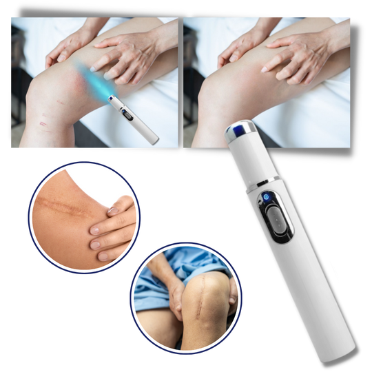 Draagbare Lasertherapie voor een Stralende Teint 3