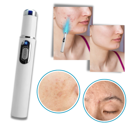 Draagbare Lasertherapie voor een Stralende Teint 4