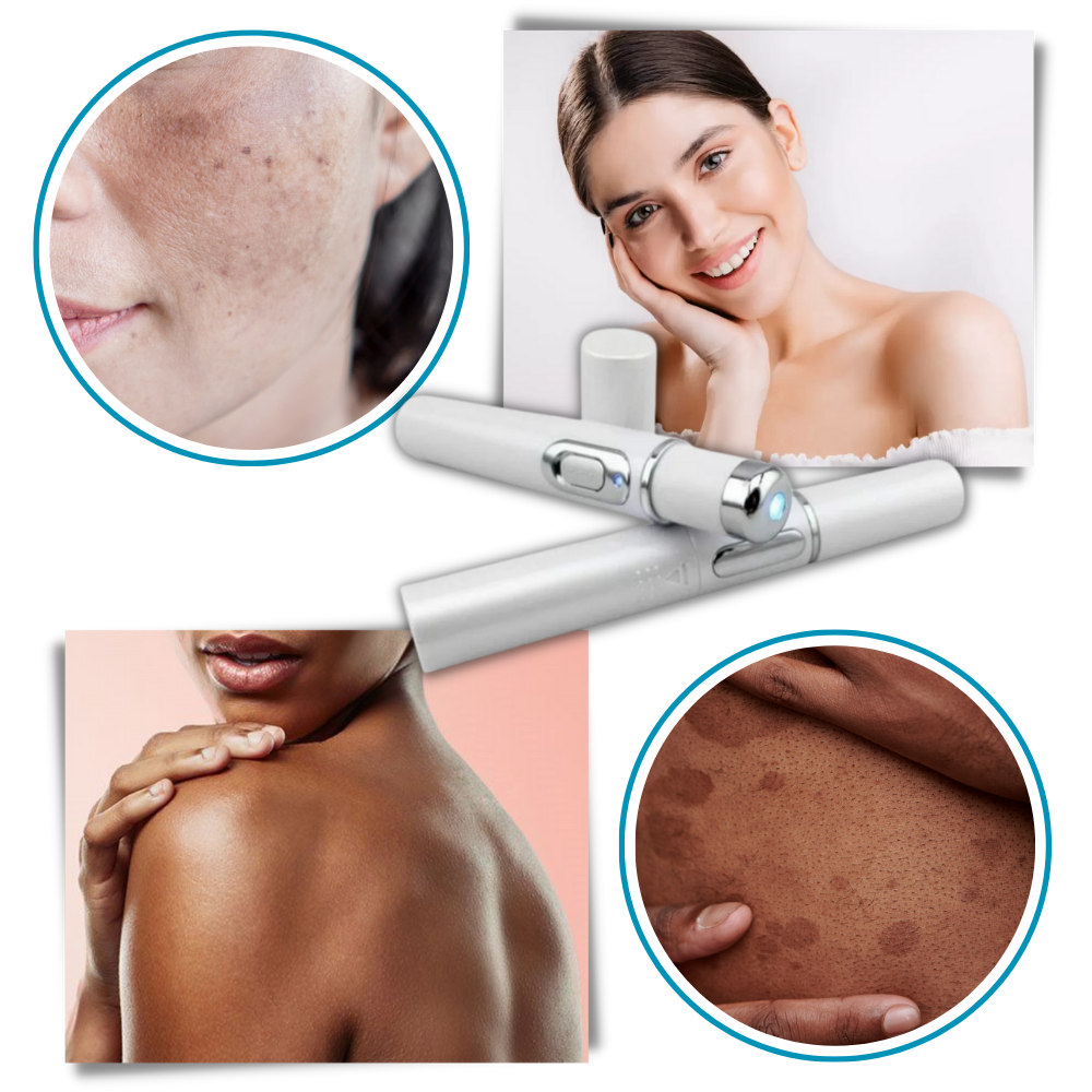 Draagbare Lasertherapie voor een Stralende Teint 5