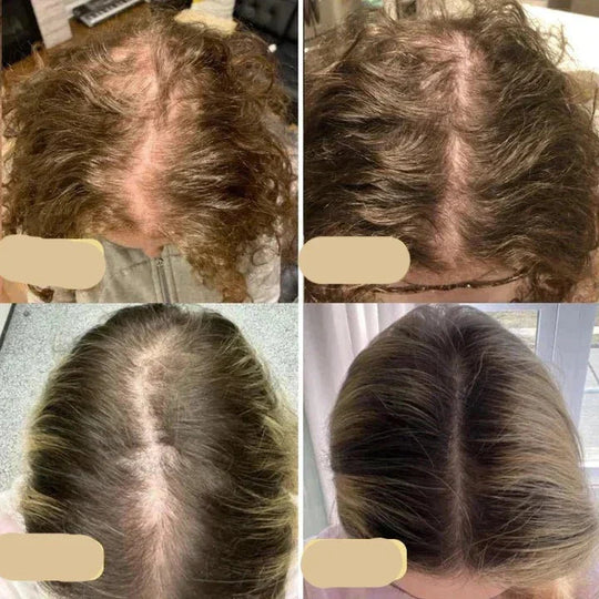 Haarverzorging Olie voor Groei en Versterking 4