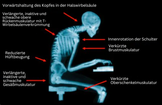 Houdingsband voor Dames en Heren - PosturePro 3