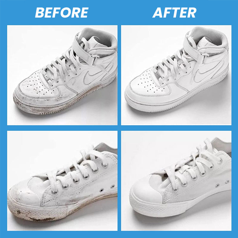 Schoen Reinigingsgel Voor Witte Schoenen Met Klemnippel 6