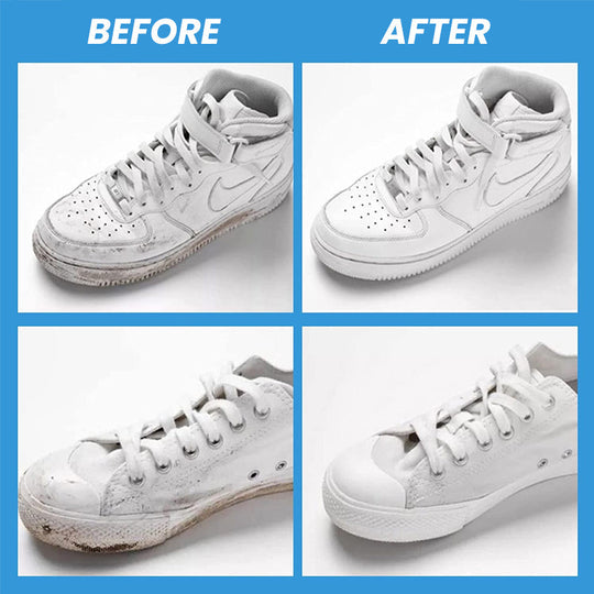 Schoen Reinigingsgel Voor Witte Schoenen Met Klemnippel 6